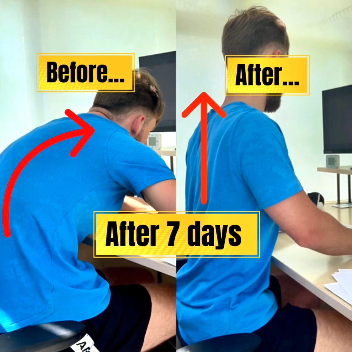 SlouchFix Pro™